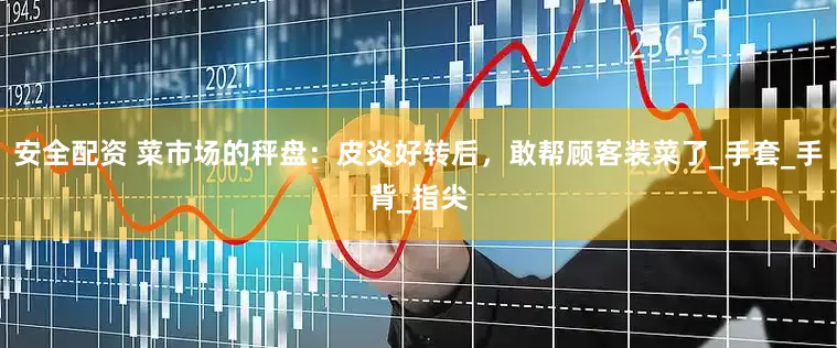安全配资 菜市场的秤盘：皮炎好转后，敢帮顾客装菜了_手套_手背_指尖